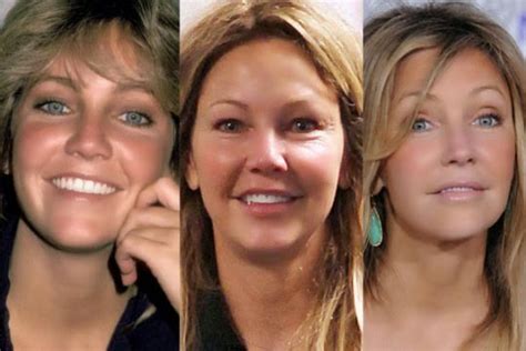 Did Heather Locklear Get Plastic Surgery Botox Injections Breast And Lips Before And After Photos