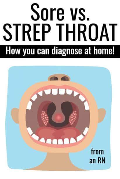How Long After Antibiotics Are You Contagious Strep Throat Bronchitis