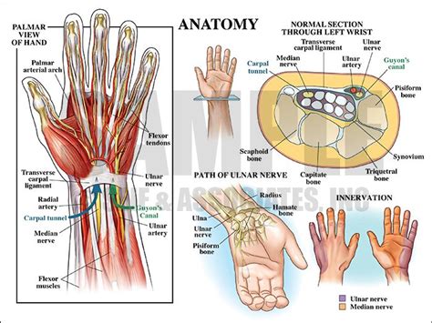 carpal tunnel carpal tunnel syndrome carpal tunnel surgery