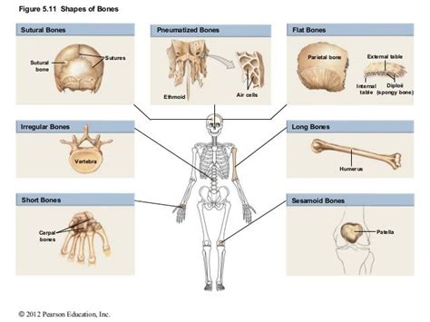 This Image Depicts The Shoes Of Bones Examples Of Flat