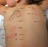 Images of What Doctor Does Allergy Testing
