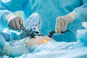 ¿Qué es una laparoscopia? - Mejor con Salud