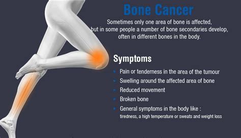 Knee Tumor Symptoms