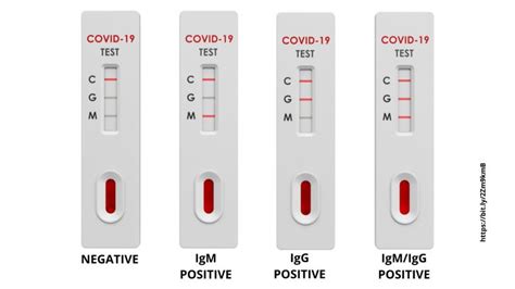 Covid 19 Antibody Test Kit Positive Cronavs