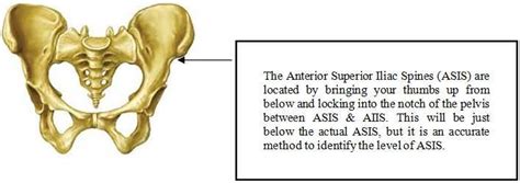 Palpation Of Anterior Superior Iliac Spine Download Scientific Diagram