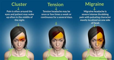 Diagnosis Of Headache Migraine Tension Cluster Stroke And Tia