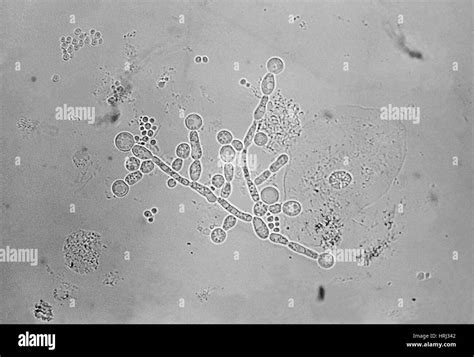 Candida Albicans Micrograph Black And White Stock Photos Images Alamy
