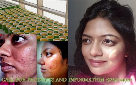 We did not find results for: SKIN CARE HERBALIFE INDEPENDENT ASSOCIATE : Results of ...