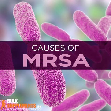 Mrsa Symptoms Causes And Treatment James Denlinger Medium