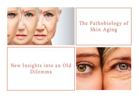 The Pathobiology Of Skin Aging New Insights Into An Old Dilemma Skin