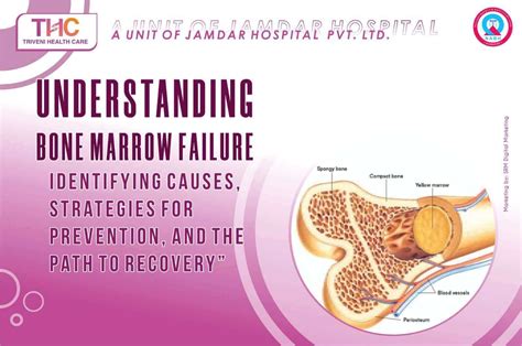 Bone Marrow Failure 5 Most Common Bone Marrow Failure