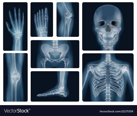 Human Skeleton X Ray