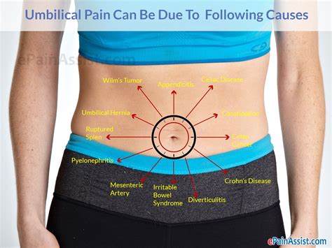 Causes Of Belly Button Pain Or Umbilical Pain