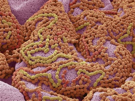 Tooth Bacteria Photograph By Steve Gschmeissnerscience Photo Library