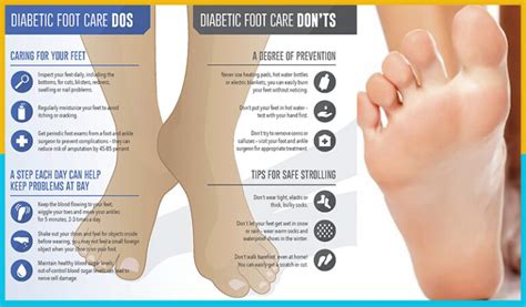 Normal Foot And Diabetic Foot Vascular Care Center