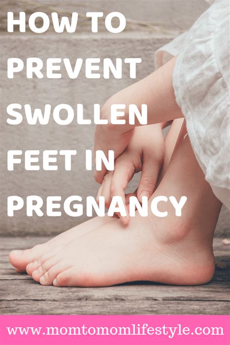 Swollen Feet During Pregnancy Mom To Mom Lifestyle