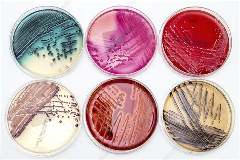 Bacterial Growth On Culture Media Stock Image C0291373 Science