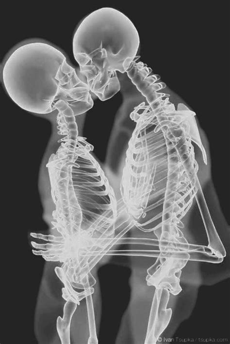85 Best Images About X Ray On Pinterest X Rays A Kiss And See Through