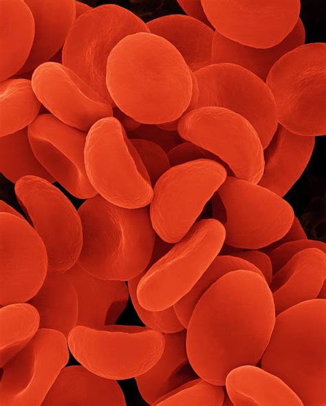 Red Blood Cells In Hypotonic Solution Photograph By Dennis Kunkel My Xxx Hot Girl