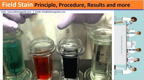 Field Stain Principle Procedure Results And More Lab Tests Guide