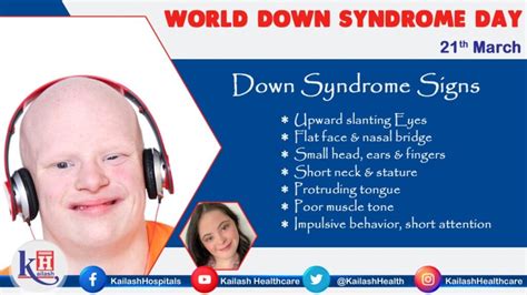down s syndrome causes a distinct facial appearance intellectual disability and developmental