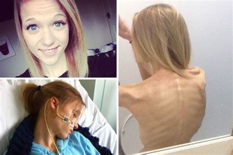 thinspiration selfies almost killed me anorexia survivor s warning as mirror investigation