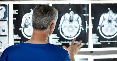 Brain Damage Types Causes And Symptoms Zamona