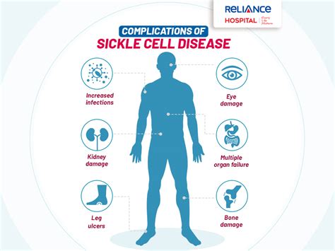 Sickle Cell Disease Emergency Guide Cdc Vrogue Co