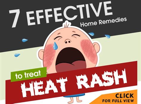 Baby Heat Rash Causes Types With Pictures And Remedies Baby Heat