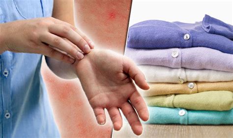 Eczema Treatment Prevent Dry Itchy Skin Condition With Diet And