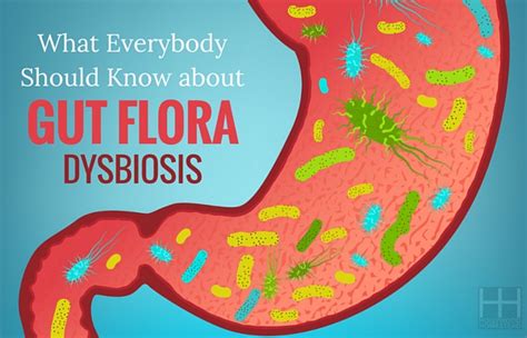 What Everybody Should Know About Gut Flora Dysbiosis Hollywood Homestead