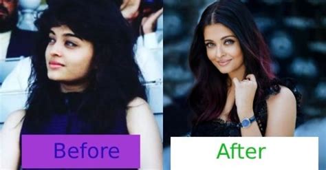 Bollywood Actresses Who Have Undergone Cosmetic Surgeries Bollywood Actresses Who Underwent