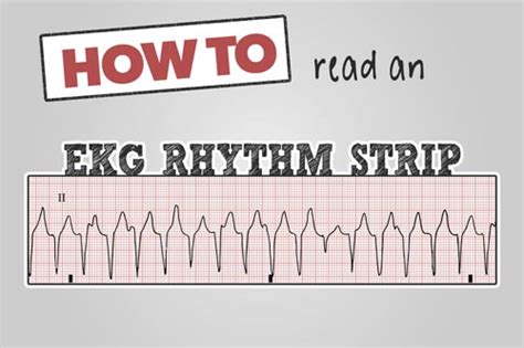 How To Read An Ekg Rhythm Strip Health And Willness