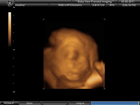 How much is a 3d ultrasound uk. How Much Does a 3D Ultrasound Cost? | HowMuchIsIt.org