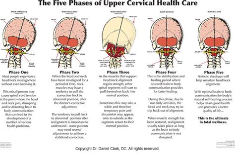 Many people experience neck pain or stiffness from injury, overuse, or inflammation. Chiropractic Reduces Unnecessary Interventions in Low Back ...