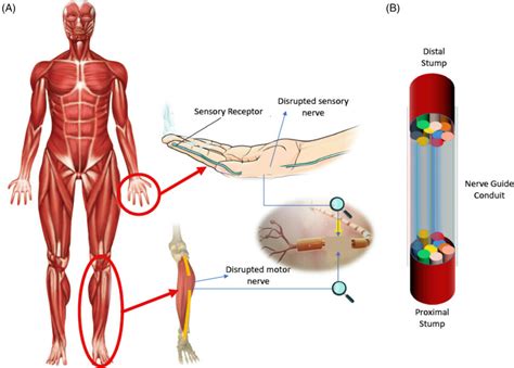 A Destructive Effect Of Peripheral Nerve Injury On Patients Bodies