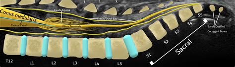 Neonatalinfant Spine Sonographic Tendencies