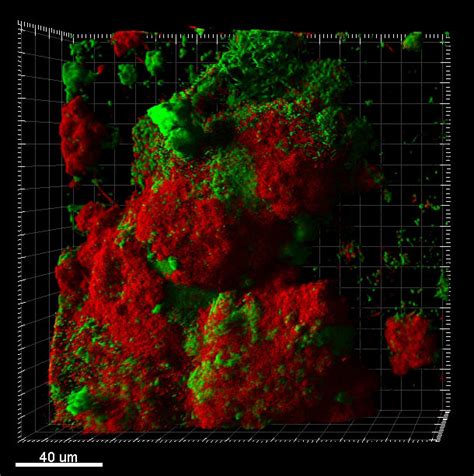 Updated on february 4, 2021 9:56 am. Food preservative kills cancer cells, superbugs | Head and ...