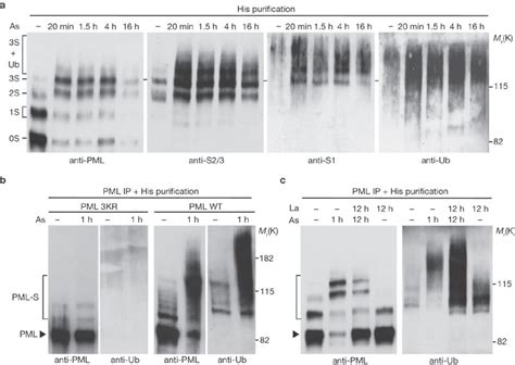 Arsenic Induces Sumoylation Ubiquitination And Degradation Of Pmla
