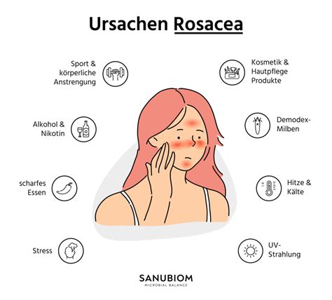Rosacea Ursachen Symptome And Behandlung Sanubiom