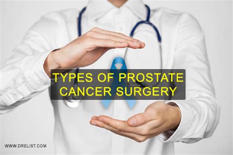 Types Of Prostate Cancer Surgery Blog
