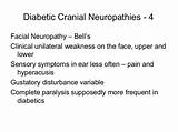 Facial Neuropathy Treatment Images