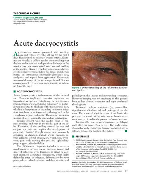 Acute Dacryocystitis Cleveland Clinic Journal Of Medicine