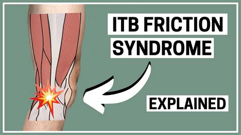 Runners Knee Itb Friction Syndrome Diagnosis And Treatment Explained
