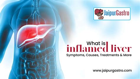 What Is Inflamed Liver Symptoms Causes Treatments And More