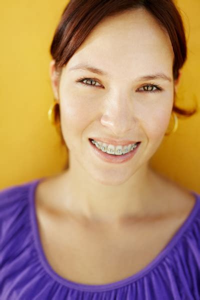 Junge Frau Mit Kieferorthopädischen Klammern Lächelnd Stockfoto 5199501 Bildagentur