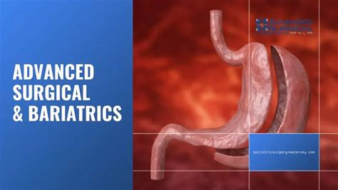 PPT Advanced Surgical Bariatrics PowerPoint Presentation Free Download ID