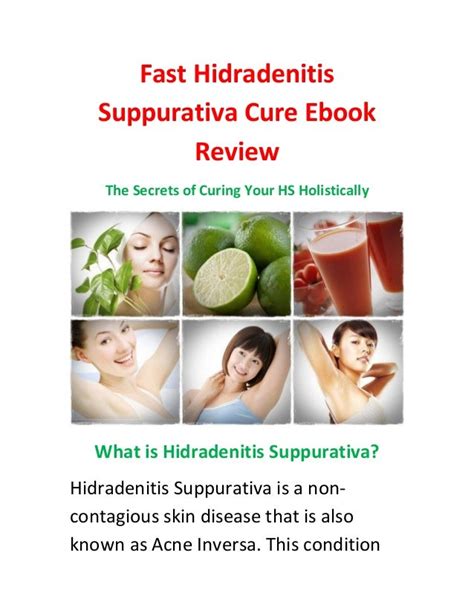 Fast Hidradenitis Suppurativa Cure Ebook Review