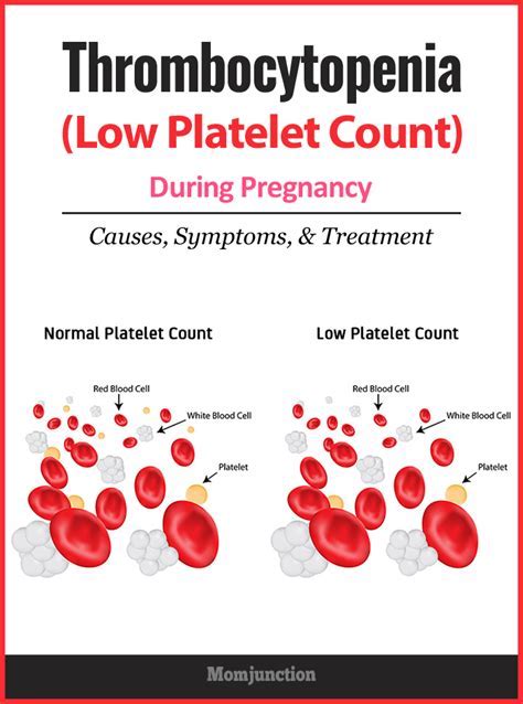 Causes Of Low Platelets