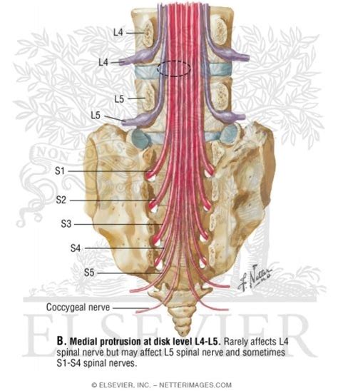 L5 Nerve Root Anatomy